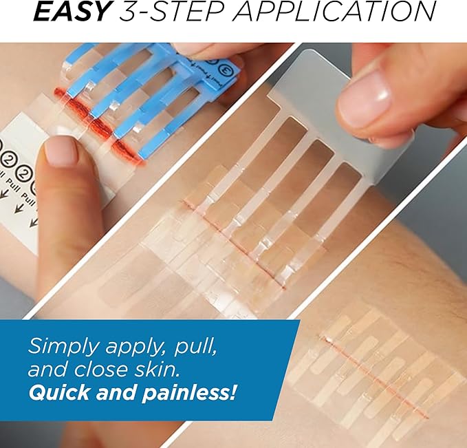 Clozex Complete Emergency Laceration Kit - Repair Wounds Without Stitches, FSA HSA Eligible Skin Clean Cover Closure Device for 2 Individual Or Combine for 2 1/2 in. Length