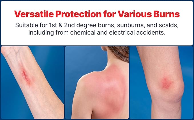 BurnFix® Burn Kit Comprehensive 25pcs First Aid Kit + Hydrogel Burn Spray - 120ml Bundle